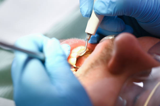Best Pediatric Emergency Dentist in Walce Ridge, LA